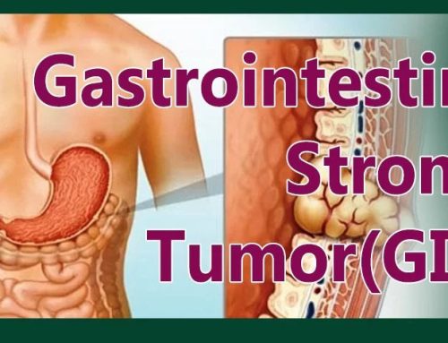 Tumori Stromal Gastrointestinal – GIST