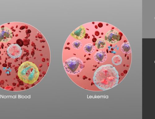 Leukemia – Kanceri i Gjakut