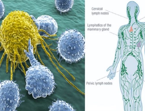 Sistemi limfatik është mënyra se si përhapet kanceri