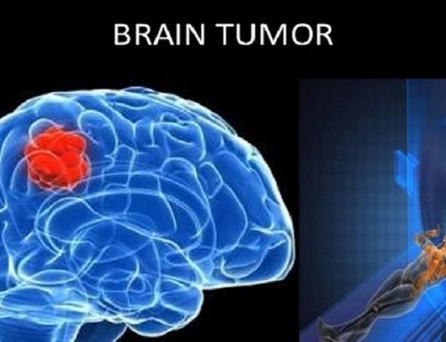 Skanet CT mund të rrisin rrezikun e tumoreve të trurit