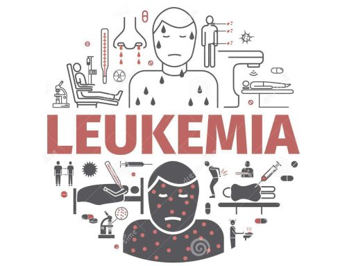 Shenjat dhe shkaktarët e Leukemisë