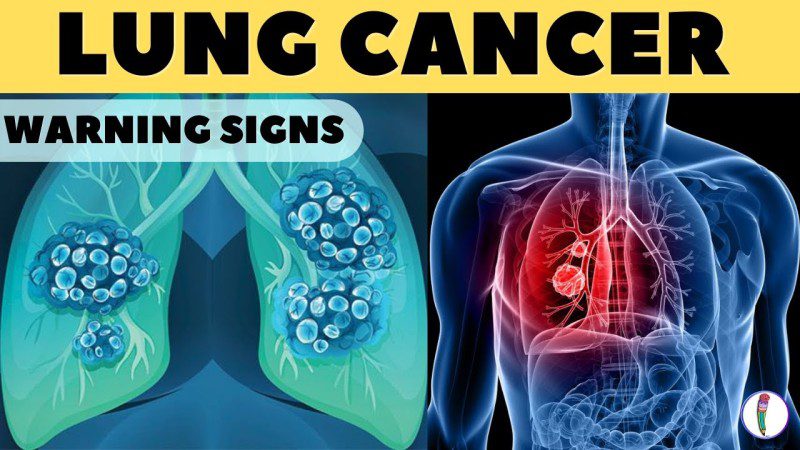 Lung Cancer Symptoms Every Non-Smoker Should Know - Arabic Herbal Medicine