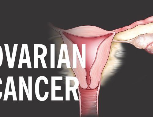 Jo kontrollit rutin të kancerit ovarian