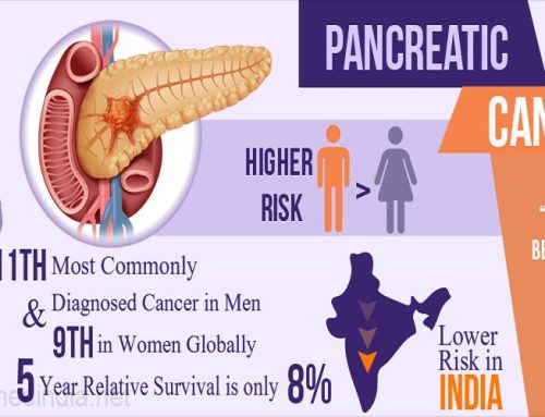 Kanceri i Pankreasit