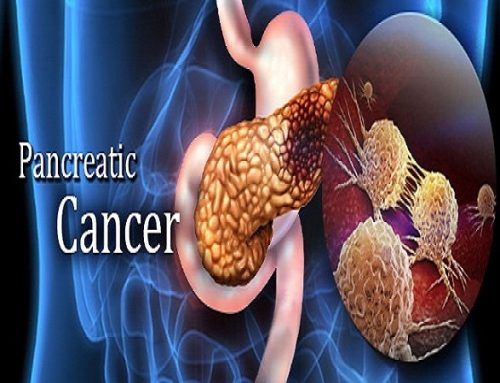 Strategjitë bazë për të zvogëluar rrezikun e kancerit Pankreatik
