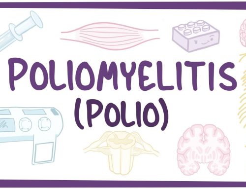 Poliomieliti; Simptomat, Shkaqet, Trajtimi Natyral
