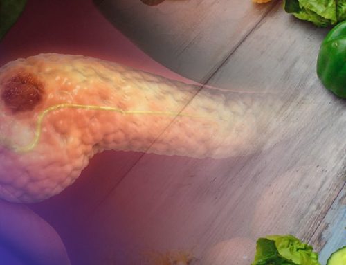 Ushqime që ndihmojnë në parandalimin e kancerit të pankreasit