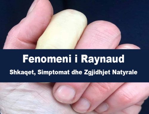 Fenomeni i Raynaud
