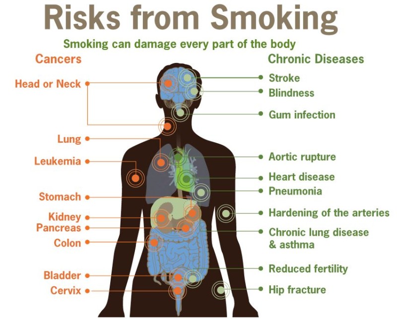 Smoking, here's what it does to the body from head to toe - Arabic ...