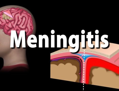 Meningjiti – A është vërtetë i rrezikshëm dhe si mund ta trajtojmë në mënyrë natyrale?