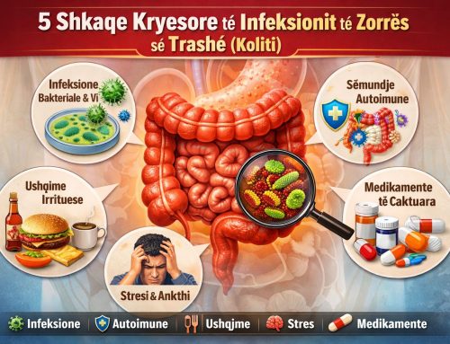 5 Shkaqe kryesore të infeksionit të zorrës së trashë (Koliti)