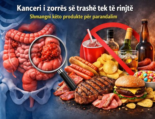 Kanceri i zorrës së trashë tek të rinjtë – Shmangni këto produkte për parandalim