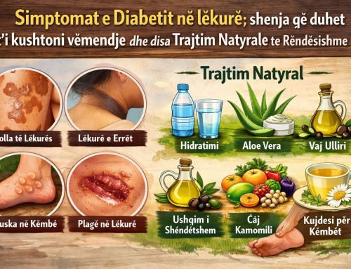Simptomat e Diabetit në lëkurë