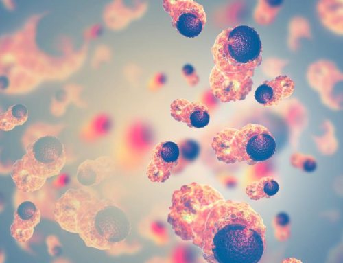 Pse zhvillohet kanceri